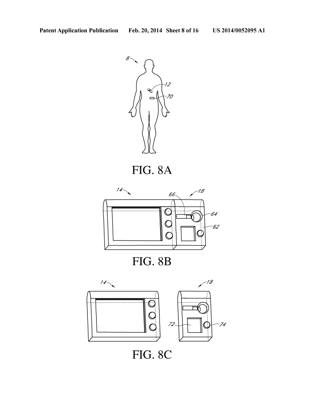 INTEGRATED INSULIN DELIVERY SYSTEM WITH CONTINUOUS GLUCOSE SENSOR - diagram, schematic, and image 09