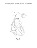 MEDICAL DEVICE WITH TEXTURED SURFACE diagram and image