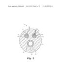 MEDICAL DEVICE WITH TEXTURED SURFACE diagram and image