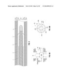 FLEXIBLE MICROWAVE CATHETERS FOR NATURAL OR ARTIFICIAL LUMENS diagram and image