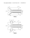 FLEXIBLE MICROWAVE CATHETERS FOR NATURAL OR ARTIFICIAL LUMENS diagram and image