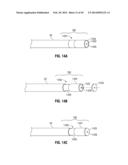 FLEXIBLE MICROWAVE CATHETERS FOR NATURAL OR ARTIFICIAL LUMENS diagram and image