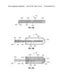FLEXIBLE MICROWAVE CATHETERS FOR NATURAL OR ARTIFICIAL LUMENS diagram and image