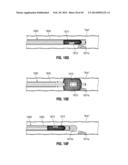 FLEXIBLE MICROWAVE CATHETERS FOR NATURAL OR ARTIFICIAL LUMENS diagram and image