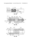 FLEXIBLE MICROWAVE CATHETERS FOR NATURAL OR ARTIFICIAL LUMENS diagram and image