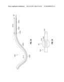 FLEXIBLE MICROWAVE CATHETERS FOR NATURAL OR ARTIFICIAL LUMENS diagram and image