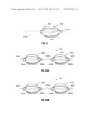 FLEXIBLE MICROWAVE CATHETERS FOR NATURAL OR ARTIFICIAL LUMENS diagram and image