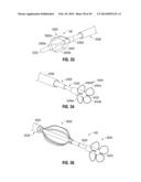 FLEXIBLE MICROWAVE CATHETERS FOR NATURAL OR ARTIFICIAL LUMENS diagram and image