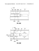 FLEXIBLE MICROWAVE CATHETERS FOR NATURAL OR ARTIFICIAL LUMENS diagram and image