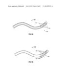 FLEXIBLE MICROWAVE CATHETERS FOR NATURAL OR ARTIFICIAL LUMENS diagram and image