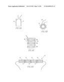 SYSTEMS AND METHODS FOR INSTALLING AND REMOVING AN EXPANDABLE POLYMER diagram and image