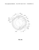 LOW PROFILE ELECTRODES FOR AN ANGIOPLASTY SHOCK WAVE CATHETER diagram and image