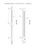 LOW PROFILE ELECTRODES FOR AN ANGIOPLASTY SHOCK WAVE CATHETER diagram and image