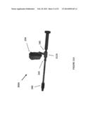 HIP REPLACEMENT NAVIGATION SYSTEM AND METHOD diagram and image