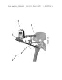 HIP REPLACEMENT NAVIGATION SYSTEM AND METHOD diagram and image