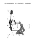 HIP REPLACEMENT NAVIGATION SYSTEM AND METHOD diagram and image