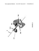 HIP REPLACEMENT NAVIGATION SYSTEM AND METHOD diagram and image