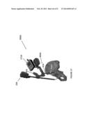 HIP REPLACEMENT NAVIGATION SYSTEM AND METHOD diagram and image