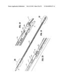 ENDOSCOPIC SURGICAL CLIP APPLIER diagram and image