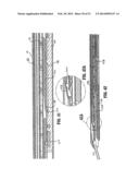 ENDOSCOPIC SURGICAL CLIP APPLIER diagram and image