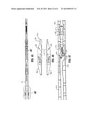 ENDOSCOPIC SURGICAL CLIP APPLIER diagram and image