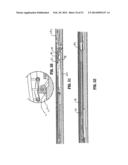 ENDOSCOPIC SURGICAL CLIP APPLIER diagram and image