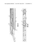 ENDOSCOPIC SURGICAL CLIP APPLIER diagram and image