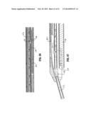 ENDOSCOPIC SURGICAL CLIP APPLIER diagram and image