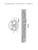 ENDOSCOPIC SURGICAL CLIP APPLIER diagram and image