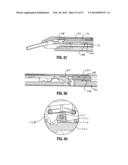 ENDOSCOPIC SURGICAL CLIP APPLIER diagram and image