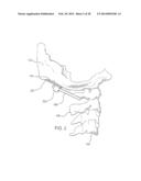 MODULAR OCCIPITAL PLATE diagram and image