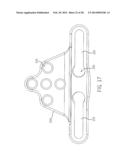 MODULAR OCCIPITAL PLATE diagram and image