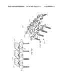 Posterior Spine Attachment Device for Hardware and Paraspinal Musculature diagram and image