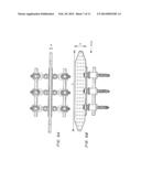 Posterior Spine Attachment Device for Hardware and Paraspinal Musculature diagram and image