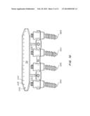 Posterior Spine Attachment Device for Hardware and Paraspinal Musculature diagram and image