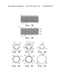 DEVICES AND METHODS FOR DELIVERY OF VALVE PROSTHESES diagram and image