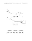 DEVICES AND METHODS FOR DELIVERY OF VALVE PROSTHESES diagram and image