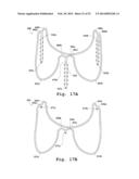 DEVICES AND METHODS FOR DELIVERY OF VALVE PROSTHESES diagram and image