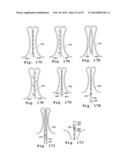 DEVICES AND METHODS FOR DELIVERY OF VALVE PROSTHESES diagram and image