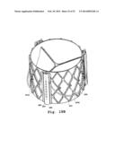 DEVICES AND METHODS FOR DELIVERY OF VALVE PROSTHESES diagram and image