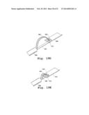 DEVICES AND METHODS FOR DELIVERY OF VALVE PROSTHESES diagram and image