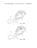 DEVICES AND METHODS FOR DELIVERY OF VALVE PROSTHESES diagram and image