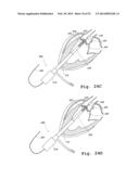 DEVICES AND METHODS FOR DELIVERY OF VALVE PROSTHESES diagram and image