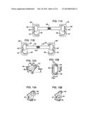 Crossbar Spinal Prosthesis Having a Modular Design and Related     Implantation Methods diagram and image