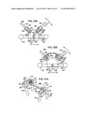 Crossbar Spinal Prosthesis Having a Modular Design and Related     Implantation Methods diagram and image