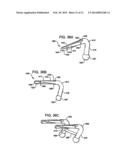 Crossbar Spinal Prosthesis Having a Modular Design and Related     Implantation Methods diagram and image