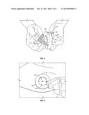 PROTECTIVE DEVICE FOR IMPLANTED MEDICAL DEVICE diagram and image