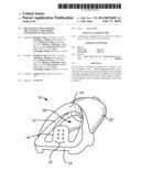 ORAL DEVICE FOR ANTERIOR ADVANCEMENT AND MEDIAL CONSTRAINT OF THE TONGUE diagram and image