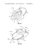 ORAL DEVICE FOR ANTERIOR ADVANCEMENT AND MEDIAL CONSTRAINT OF THE TONGUE diagram and image