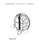 ANTI SLIP DEVICE FOR A WHEEL AND A METHOD FOR MOUNTING THE ANTI SLIP     DEVICE diagram and image